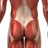 Low Back - Myofascial Pain Syndrome (muscle pain)